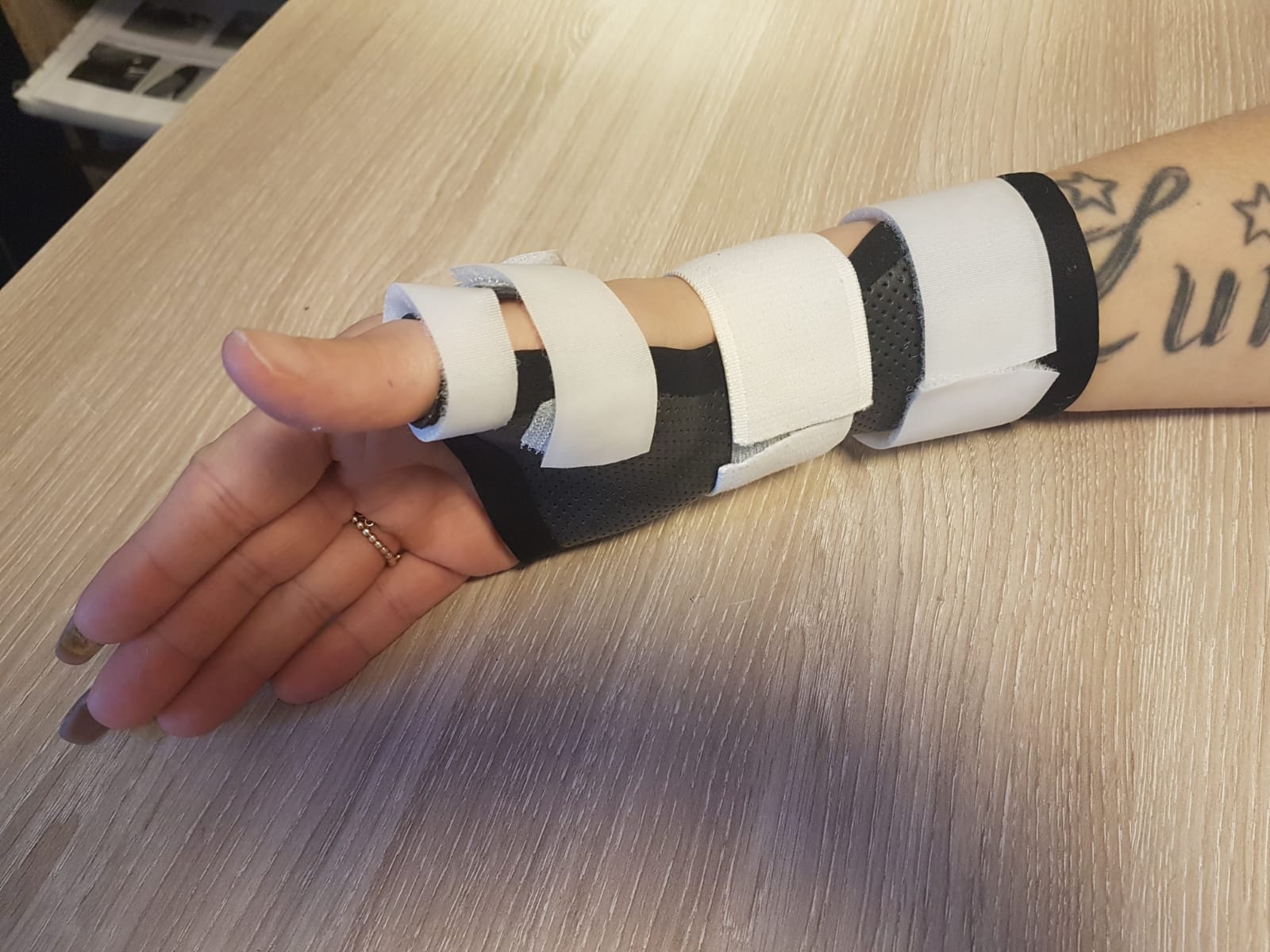 ORTHOPHYSIO-lesion-nerf-radial