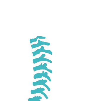 Tassement vertébral stable