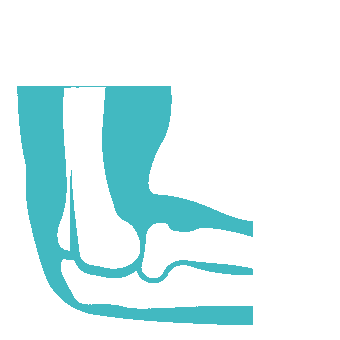 Épicondylite - tennis elbow