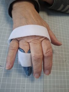 Orthèse sur mesure pour doigt à ressaut portée, vue du dos de la main